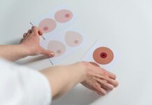 La Asociación contra el Cáncer en Cuenca descarta fallos en los cribados de mama en la provincia