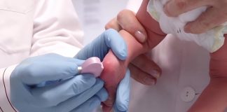 La «prueba del talón» en recién nacidos detecta ya 34 metabolopatías en Castilla-La Mancha