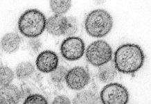 Todo sobre los hantavirus